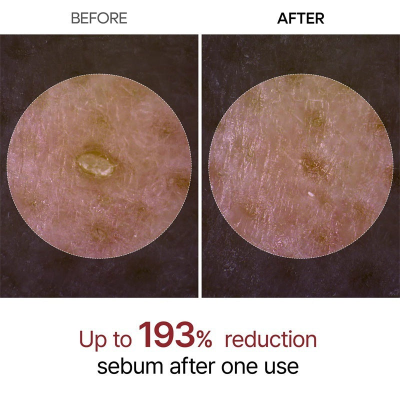 Glow Surge Resurfacing Peel Shot Fades Dark Spots & Clears Blackheads