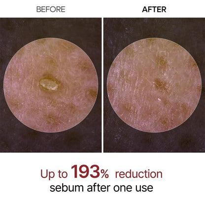 Glow Surge Resurfacing Peel Shot Fades Dark Spots & Clears Blackheads